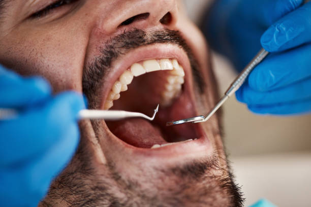Best Emergency Dentist for Knocked-Out Tooth in Marsing, ID